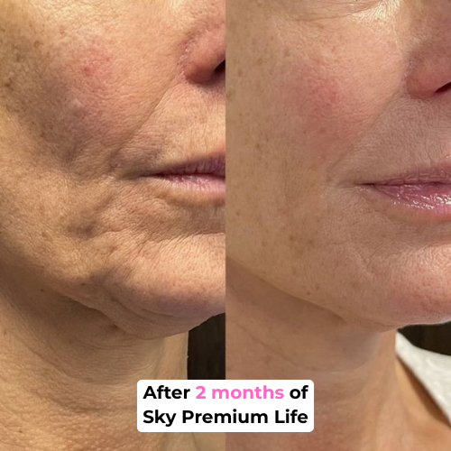 Hydro Collagen